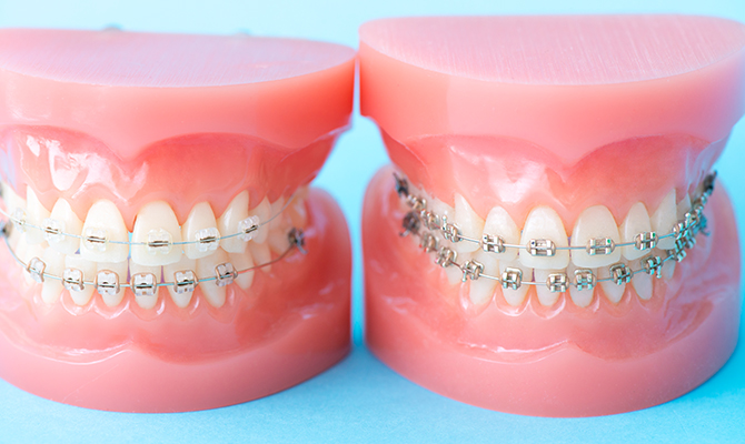 矯正歯科で取り戻すお口の見た目と健康